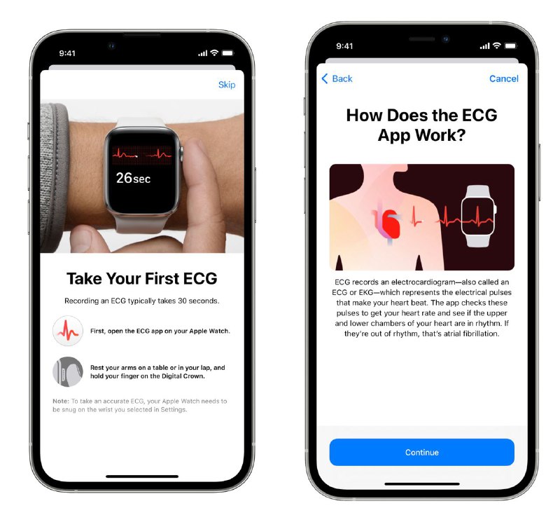 🫀中国大陆正式解锁 Apple Watch 的 ECG 心电图功能经过我的测试，正式确认中国大陆范围内已经解锁 Apple Watch 的 ECG 心电图（算法版本 v1）功能，同时可以检测正常心率下的房颤