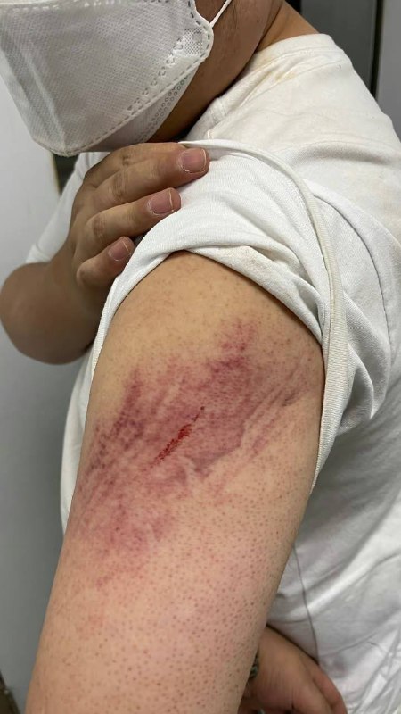 #苹果车祸检测或是人工客服 ，类似于汽车上面的安吉星救援最近短视频平台上一位 ID 为@喜猫 的小伙骑摩托车出了车祸，他当时戴着的正是刚刚购买几天的 Apple Watch Ultra 智能手表，这次车祸触发了苹果的车祸检测模式